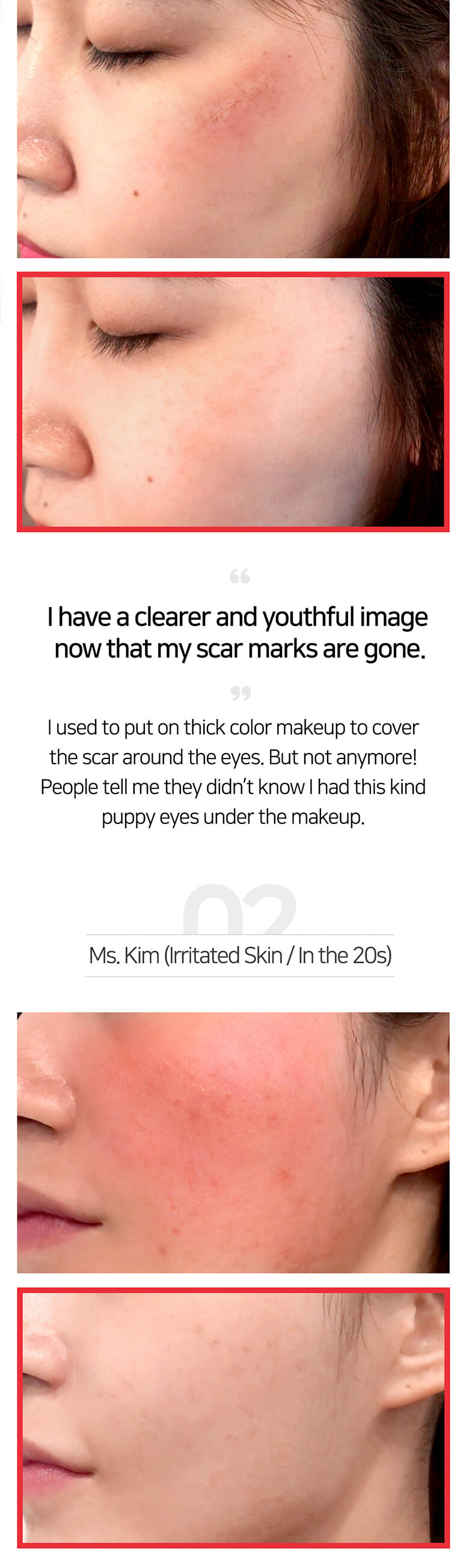 snail true cica miracle repair serum ,snail true cica miracle repair serum review ,snail true cica miracle repair serum 50ml , some by mi snail รีวิว ,some by mi snail true cica ,some by mi snail true cica รีวิว ,some by mi snail true cica repair serum ,some by mi snail true cica serum รีวิว